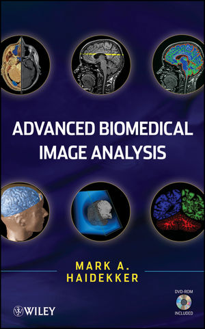 Advanced Biomedical Image Analysis Cover